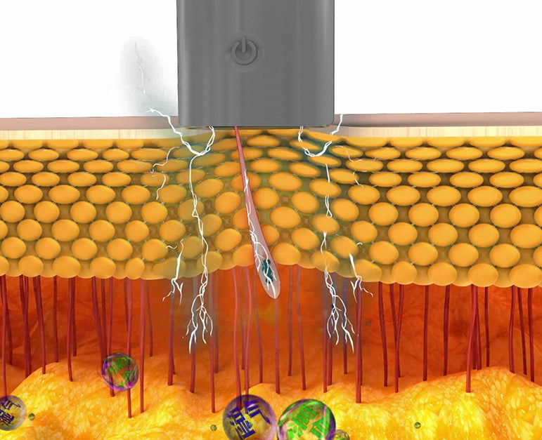 Electric Silicone Cupping Massage Set